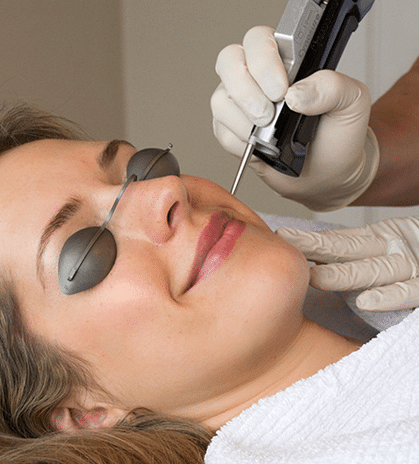 Laser Revitalization Facial