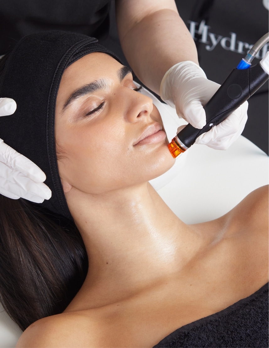 Woman receiving Collagen Induction Therapy treatment at Olakino Laser + Skin in Victoria BC