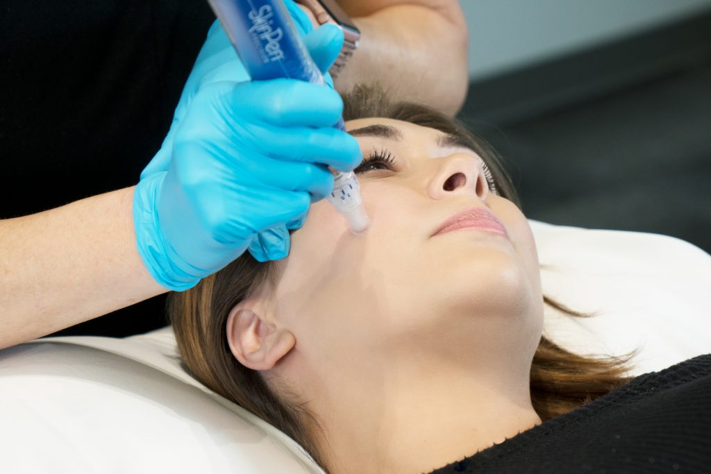 Woman receiving microneedling treatment in Victoria Woman receiving microneedling treatment in Victoria