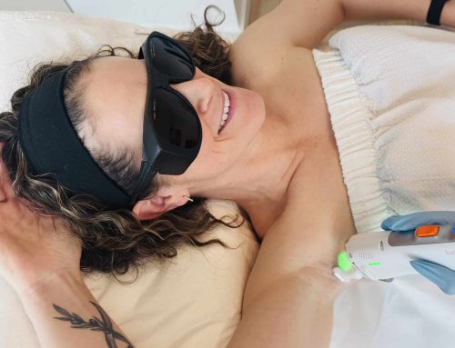 How Many Laser Hair Removal Sessions? | Victoria BC